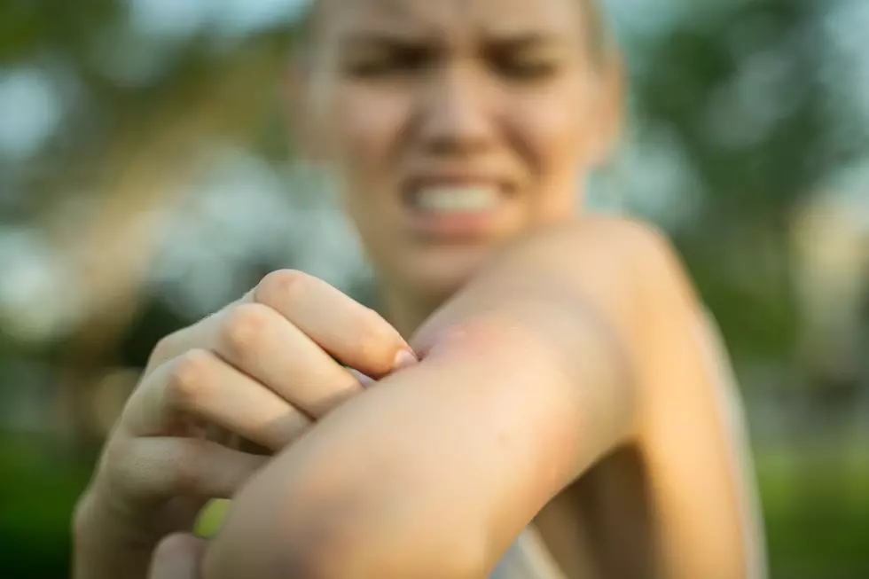 Sioux Falls Facing An Onslaught Of Pesky ‘No-see-ums’ Bug Bites
